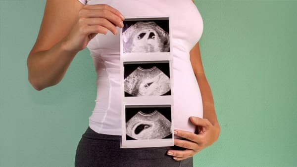 Ne croyez pas tout ce que vous entendez : 6 mythes courants sur les grossesses gémellaires