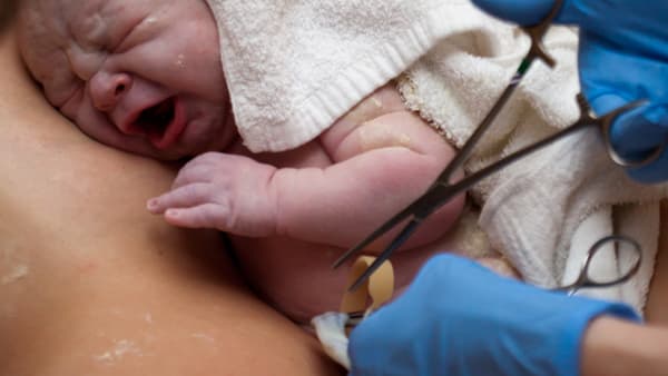 Efterbörd, adrenalin och förlossningsbrickan – det händer när bebisen är ute
